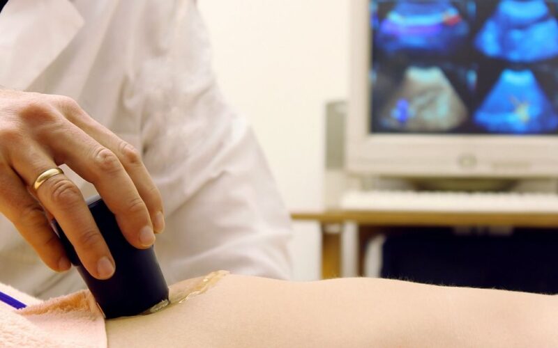 ultrazvuk-creva-kod-dece-ultrazvucna-ordinacija-polina